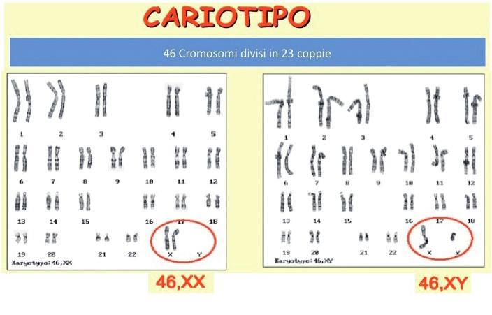 Solo 3 anni dopo la scoperta del corretto numero di cromosomi, il professor Jérôme Lejeune, insieme al professor Raymond Turpin e alla dottoressa Marthe Gautier, il 26 gennaio e il 16 marzo 1959