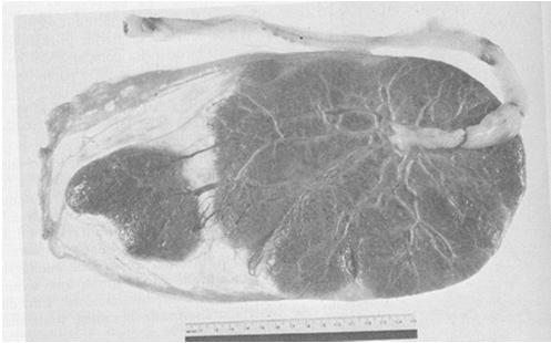 corpo placentare principale con il quale