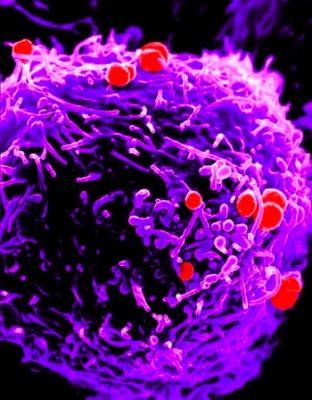 Trasmissione degli agenti biologici PARENTERALE HBV, HCV, HIV VIA AEREA (< 5 m) BK, morbillo, varicella, SARS, psitaccosi, antrace DROPLETS (< 5 m) pertosse, difterite, meningite meningococcica,