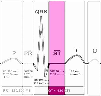 Tredicesimo passo: il segmento ST Normale ST: Dura di circa 80/120 ms (2/3 quadretti) Isoelettrico e circa allo stesso livello del segmento PR Il ventricolo rimane depolarizzato durante la fase