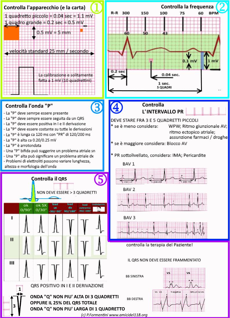 I SETTE PASSI rapidi per l interpretazione dell ECG Pur trattando una analisi rapida, ma più approfondita,