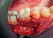 La interattività con i docenti può proseguire dopo ciascun corso durante il trattamento ortodontico dei pazienti nel proprio studio odontoiatrico.