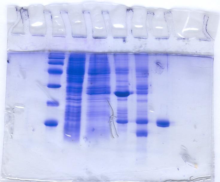 CONSERVAZIONE DEL GEL Il gel sviluppato può essere conservato a lungo termine se essiccato