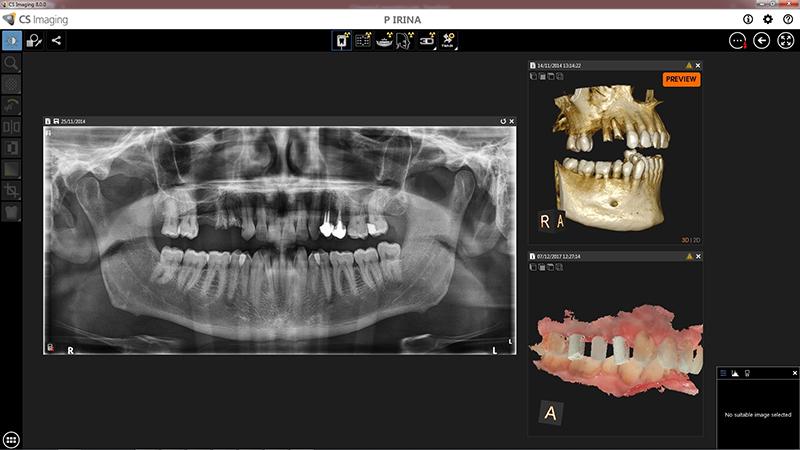 diagnostiche Facilita i confronti d immagini pre e post operatorie visualizzando le immagini 3D fianco a fianco L imaging