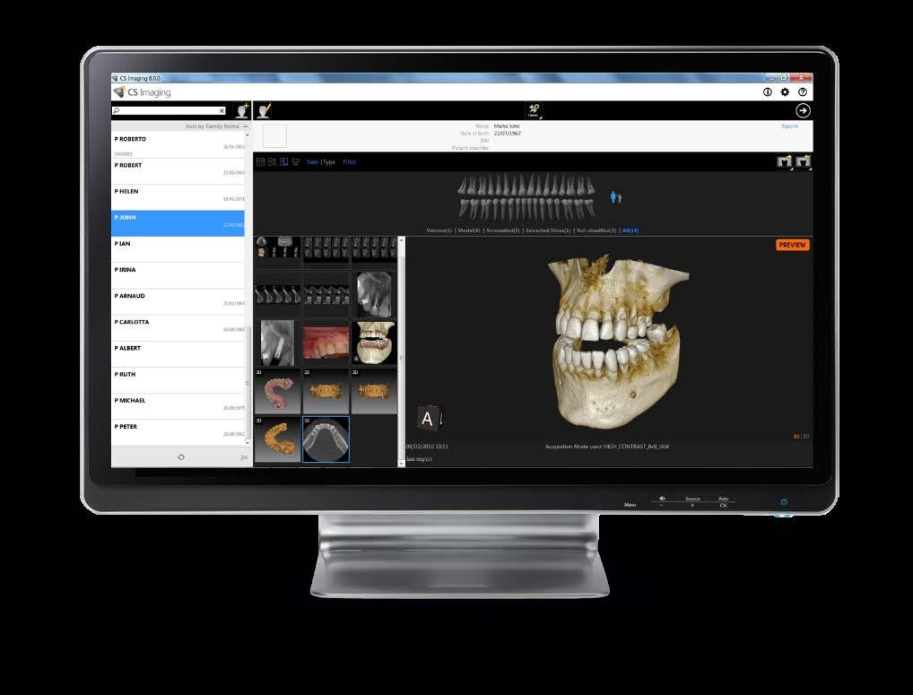 CS Imaging Version 8 Migliora la diagnosi Potenti strumenti di analisi e confronto inter-immagine Facilita la collaborazione Facile condivisione dei dati con l équipe di trattamento Flusso di lavoro