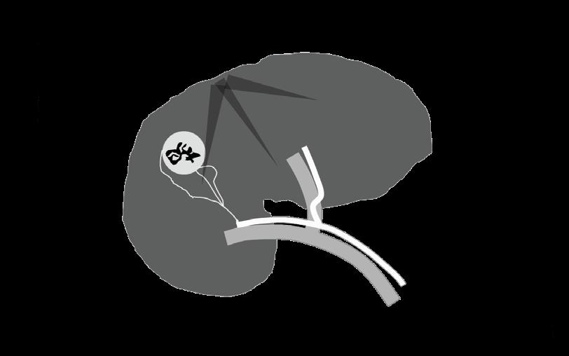 PALERMO 10-11 MAGGIO 2019 Aula Congressi Dipartimento Oncologico La Maddalena EVOLUZIONE DELLA GESTIONE CLINICA dell