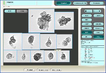 cellulare e con nuclei che evidenziano uno