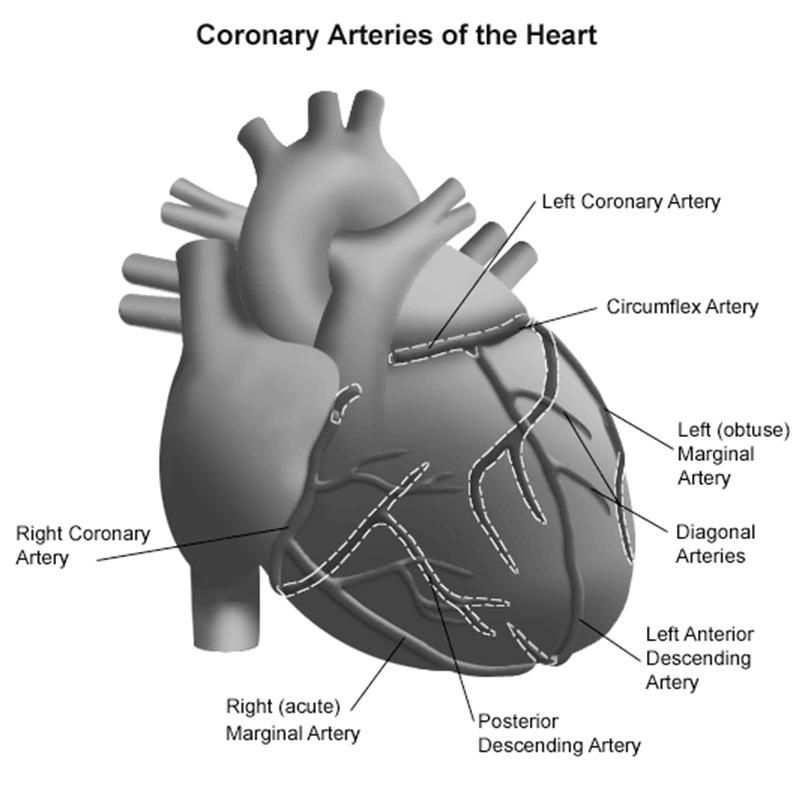 La rivascolarizzazione, quando necessaria, può essere effettuata dal cardiologo interventista con l'angioplastica coronarica mirata all'impianto di stent, e dal