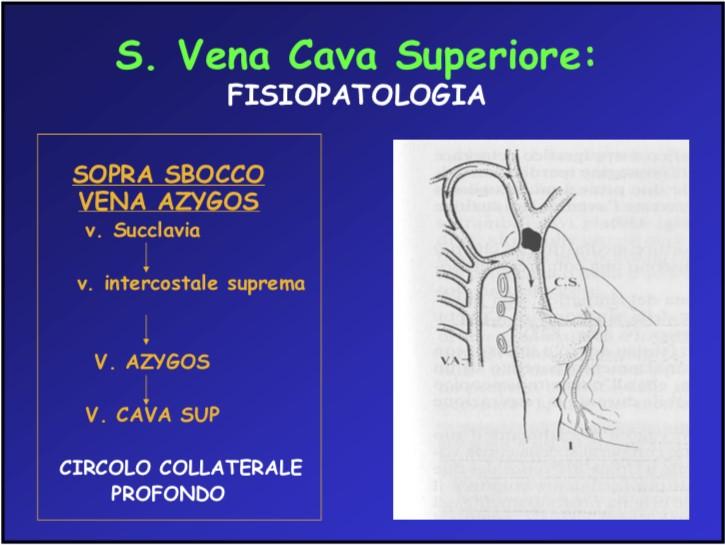 Fisiopatologia Se l ostruzione è al di sopra dello sbocco della v.