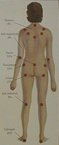 POSIZIONE SUPINA: regione del sacro, apofisi spinose vertebrali, spina della scapola, nuca, talloni.