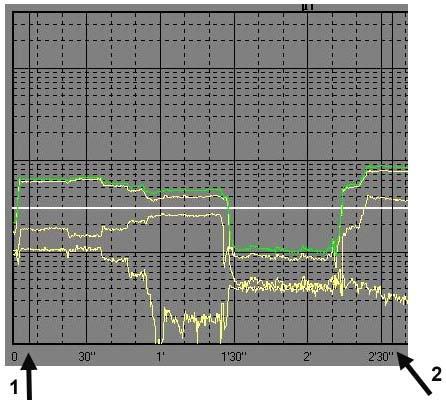 Selezionando il pulsante Zoom Mode (7), si ha la possibilità di far muovere il Marker (indicato nella figura con il triangolo blu) sul grafico dell asse X o Y o Z o sul grafico del valore totale