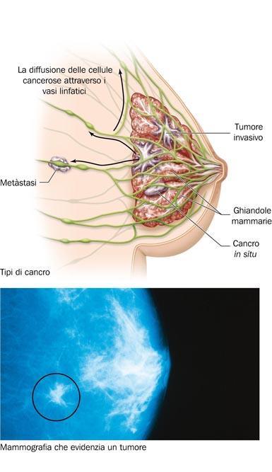 Le cellule cancerose hanno caratteristiche anomale Le cellule cancerose non sono specializzate, non contribuiscono al funzionamento degli organi e presentano un