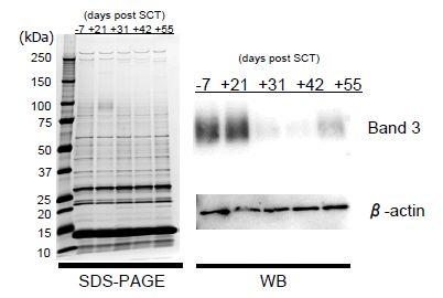 CRP In vitro 2 SDS-PAGE band3 PRDX2