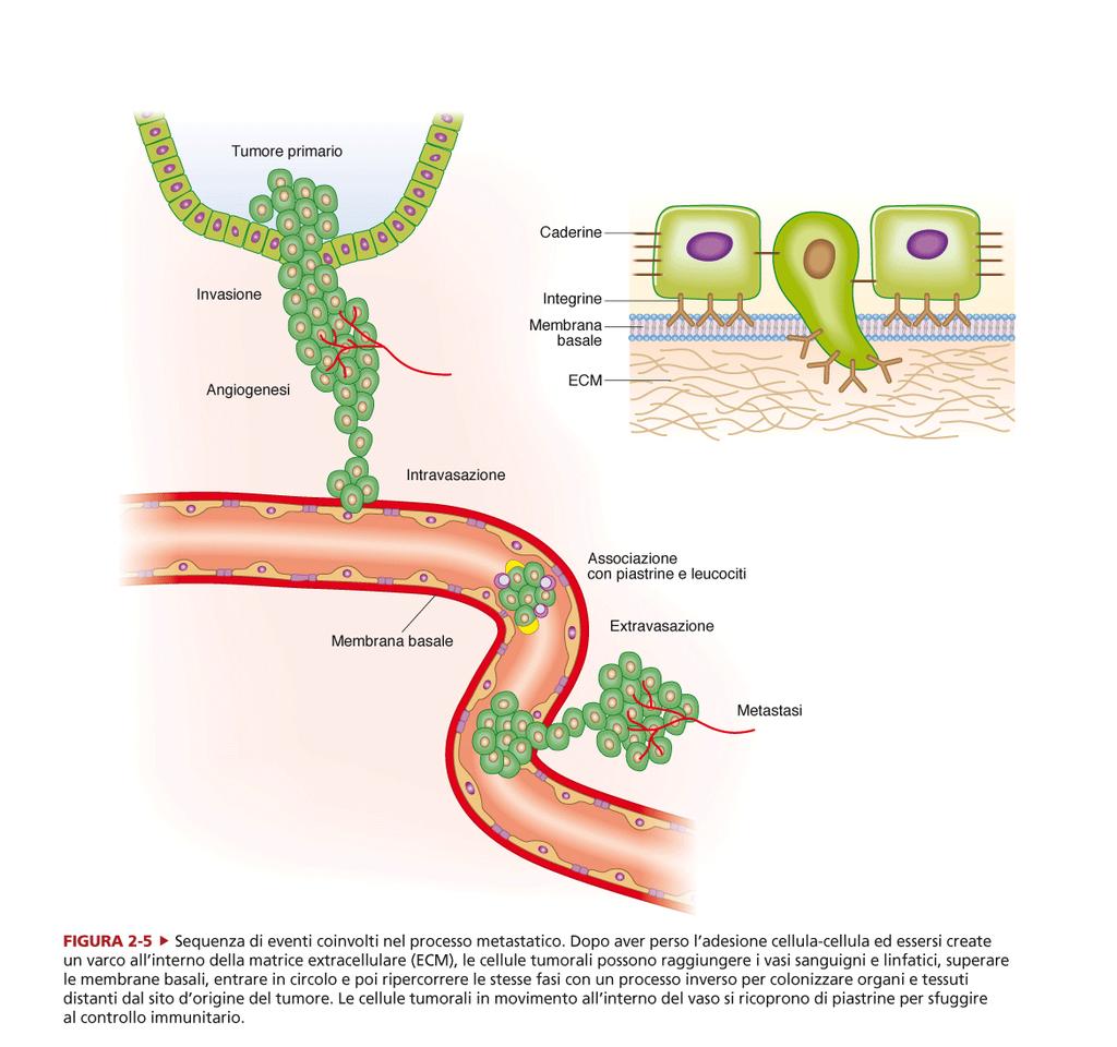 Le cellule metastatiche ricevono dalle piastrine la spinta necessaria al loro sviluppo.