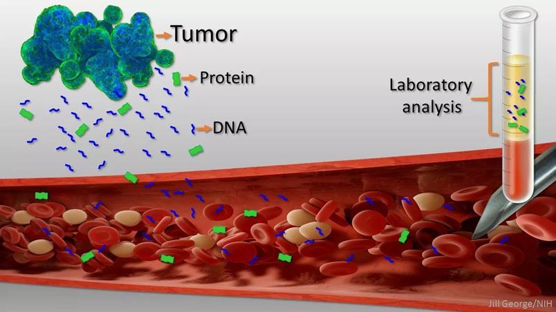 La biopsia