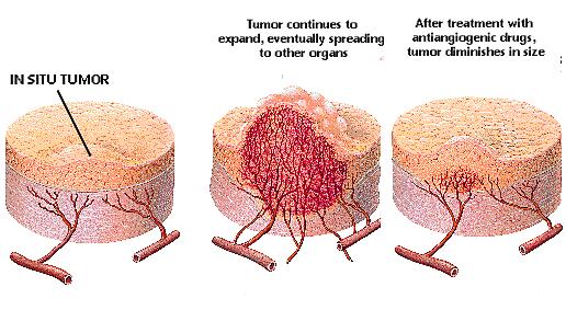 Inibizione dell angiogenesi come terapia antineoplastica