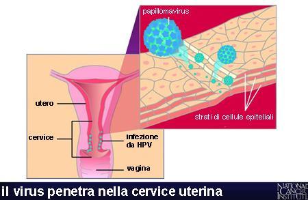 proteine, chiamate E6 e E7, che si legano e