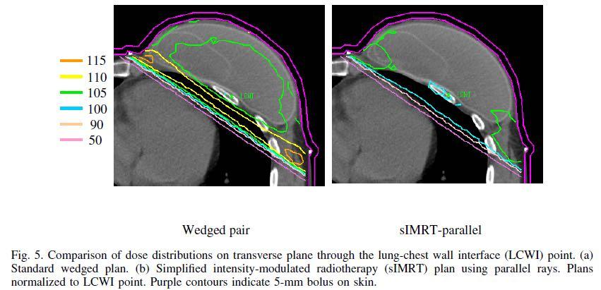 IMRT semplificata MSKCC Da Chui CS et al.