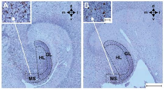 Riduzione della neurogenesi nei feti con SD La fascia dentata ippocampale è una regione in cui sono presenti molte cellule progenitrici alcune delle quali rimangono tali anche nella vita