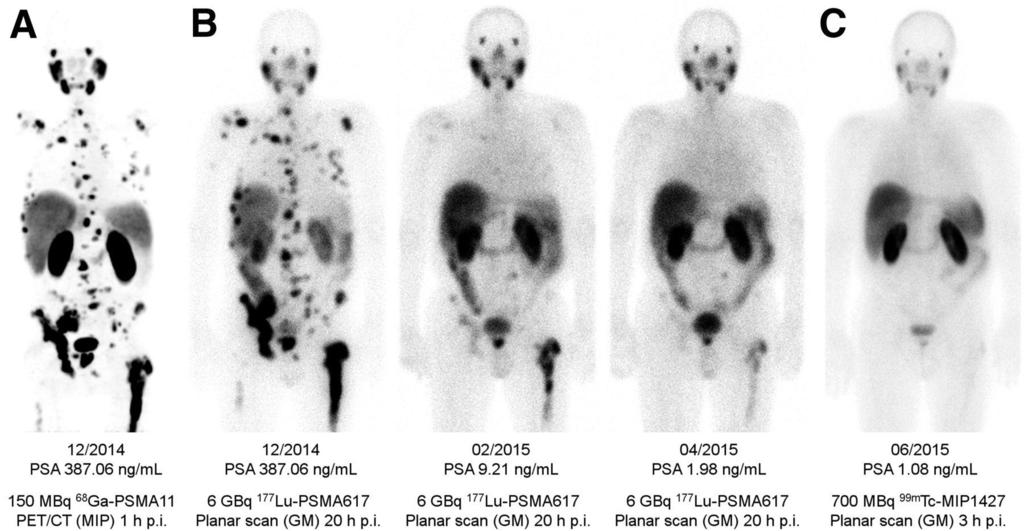 THERAGNOSTICS Carcinoma