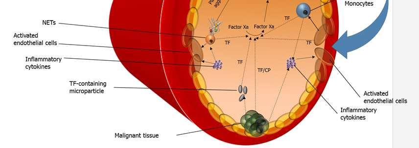 Pathogenesis CP, cancer procoagulant; NET, neutrophil