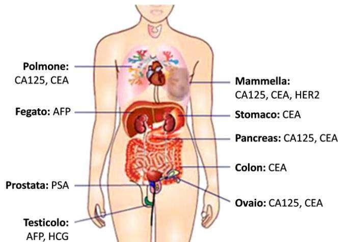 Biomarkers glicoproteici ematici usati più comunemente nei tumori Tumori del Colon: CEA, C19.