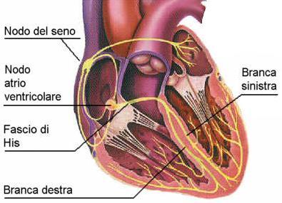 TACHICARDIA SOPRAVENTRICOLARE (TSV) E un aritmia che origina nello spazio compreso tra l approdo cardiaco delle vene e il fascio di His; La frequenza cardiaca varia da 130 a 300 bpm, in base all età