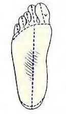 La dissezione della pianta del piede può essere effettuata con diversi approcci.
