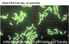 Immunofluorescenza diretta Permette di evidenziare le legionelle anche dopo alcuni giorni dall inizio della terapia antibiotica L.