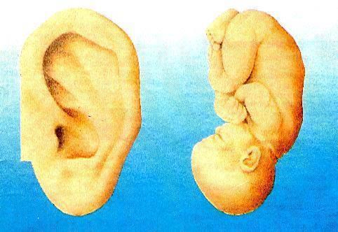 Il Padiglione Auricolare è la rappresentazione di un feto rovesciato Le differenti aree del padiglione auricolare sono geneticamente dedicate a ricevere le informazioni specifiche di una determinata