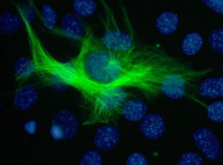 L actina è presente in tutte le cellule eucariotiche, rappresenta il 5% delle proteine cellulari.