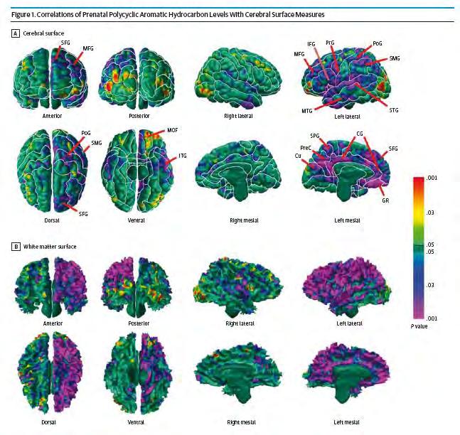 esposizione ad IPA Bassi livelli di cloriprifos e piombo nel cordone ombelicale Assenza di esposizione a fumo passivo Tutti i 255 bambini all età fra 7-9 anni sottoposti a test intellettivi,