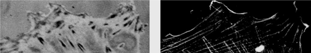 Microfilamenti di actina