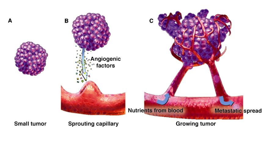 Lo Switch Angiogenico A, Tumors less than 1 mm 3 receive oxygen and nutrients by diffusion from host vasculature. B, Larger tumors require new vessel network.