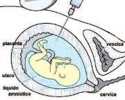 PER SAPERNE DI PIU' I test diagnostici sono esami invasivi, cioè utilizzano componenti che sono all interno dell utero (liquido amniotico o placenta).