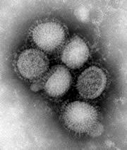 INFLUENZA DA VIRUS DI ORIGINE MESSICANA Aggiornamento al 11 Giugno 29 Dagli ultimi Comunicati emessi dal Ministero del Lavoro delle Politiche Sociali dello Stato no e dall Organizzazione Mondiale