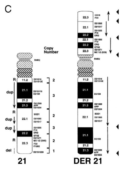 del locus Trisomia 21