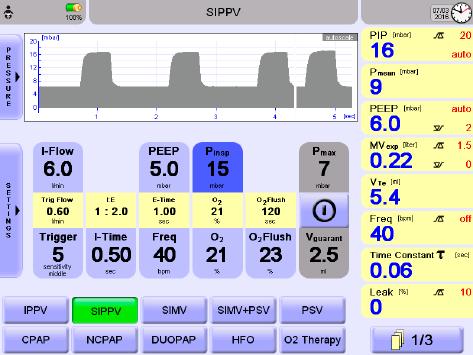 ventilazione non invasiva (NIV) ORIENTATO AL FUTURO Le modalità di ventilazione neonatale e pediatrica (IPPV, SIPPV, SIMV, PSV e SIMV+PSV), dotate di regolazione indipendente del flusso inspiratorio