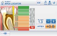 Durante gli interventi in endodonzia, il display fornisce i dati fondamentali, anche con una visualizzazione dedicata ed intuitiva a beneficio di un workflow agevolato, efficiente e veloce.