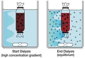 Dialisi Separazione dei soluti presenti in un liquido tramite la loro diffusione attraverso una membrana