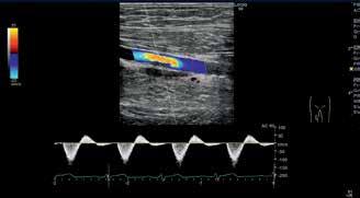 STRAORDINARIO IMAGING Riferendoci al famoso detto di Archimede che con una leva abbastanza lunga avrebbe potuto muovere il mondo, ora, con l innovazione, ci sono nuove possibilità.