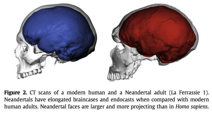 Il nostro cervello si differenzia da quello di tutte le altre specie di ominini.
