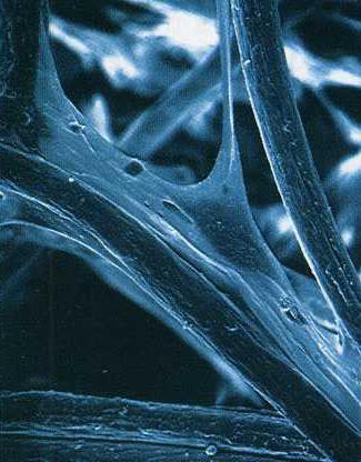 A B (A) Fotografia al microscopio elettronico a scansione di fibroblasti umani in coltura (B) I