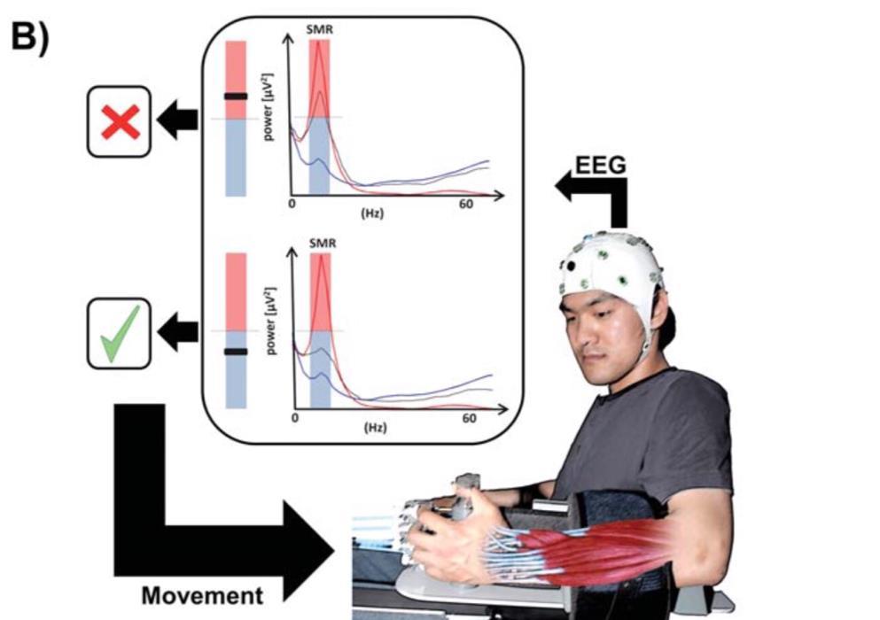 I tredici studi esaminati da Monge-Pereira et al (2017) [31], sfruttavano le seguenti feature del segnale EEG per la BCI: a) l ERD ipsilesionale del ritmo mu (3 studi); b) l ERS e l ERD bilaterale