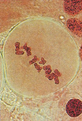 Metafase I Nella metafase I le coppie di cromosomi