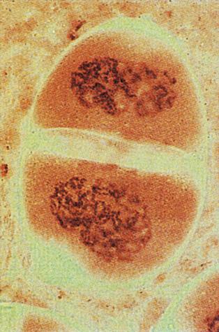 L eventuale membrana nucleare si disintegra e si