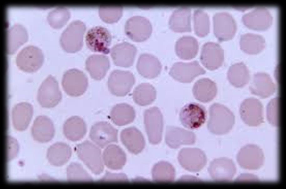 3 Genere Plasmodium P. malariae schizonte P.