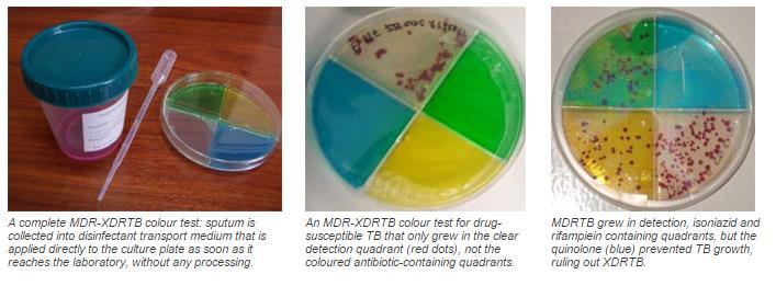 AST: tecniche fenotipiche rapide MDR-XDRTB Colour Test: antibiogramma diretto.