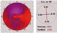 occhiali. Se la cornea non ha subito modifiche, dovute ad una variazione di forma causata dalle lenti a contatto, il cambio avviene senza provocare alcuna riduzione del visus.