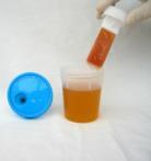 Sgocciolare l eventuale eccesso di urina appoggiando l estremità dello slide contro la parete del contenitore dell urina.